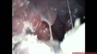 Endoscopy while crushing food