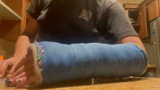 Sticky, stinky and dirty! Day 10 in this arm cast