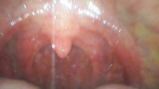 APOLLO: Intruder's Endoscope Journey: From Entry to Exit - Vore Macrophilia