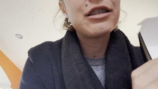 Messy burger eating with braces