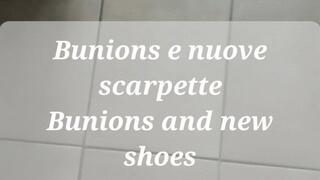 Bunions and new shoes