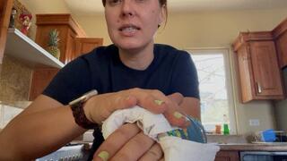 Trying to clean my fingers in my dirty arm cast
