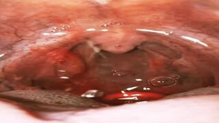 Eating gummies with sparkling water - Experience Vore uvula wide open 4K