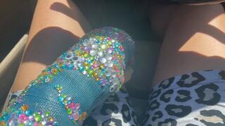 Driving my car with my arm cast