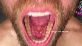 Andrew Teeth Bottom Molars and Retainer Part17 Video1 - WMV