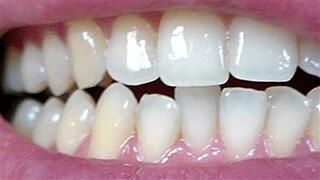 snow-white fangs clip