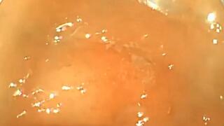 The doctor explores my belly full of meat to digest - FullScreen Exploration 720HD