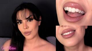 Mouth tour with my aligners! Week 4 ~ Sweet Maria