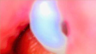 Endoscope Camera Inside My Pink Pussy Records How He Fills Me With Cum - Couple Keyla & Lucas