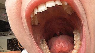 Yawning with a big wide mouth and big teeth! MP4