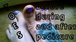 Lady Angela hand held toes before during and after a pedicure