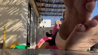 Wrist cast and dirty feet