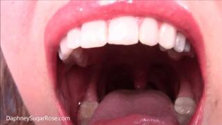 854x480p * A Little Pest Stuck in My Mouth -Mp4