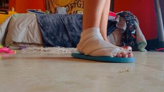 Flip-flops, dirty feet, and injured ankle