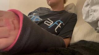 Short arm cast relaxing