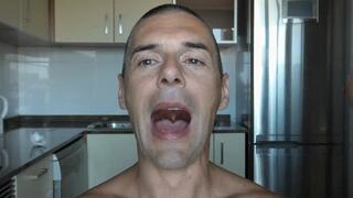 Uvula Martina ORDER a