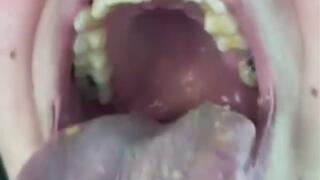 Mel's Mouth SUPER CUT