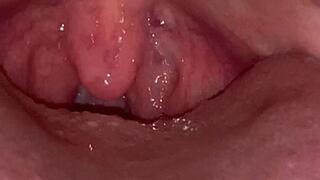 The hissing of a snake with the trembling of the uvula