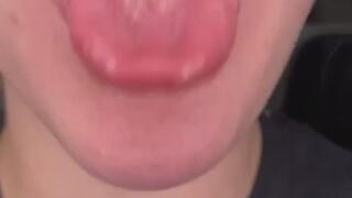 Large Tongue and Throat