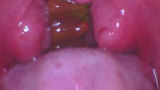 Endoscope Gummy Gulp 2