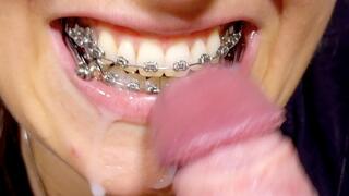 Braces HERBST German dirty-talk, HUGE cumshot