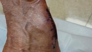 Tempest showing foot after cast removed