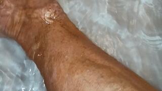 In the tub and muscular calves after cast was removed