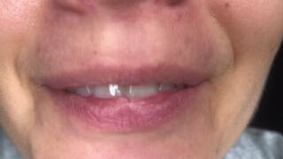 Eating and burping in your face while we are having a date