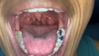 Get a good look inside my mouth