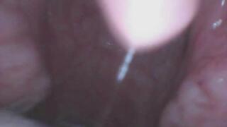 Felicia RAW ENDOSCOPE FOOTAGE