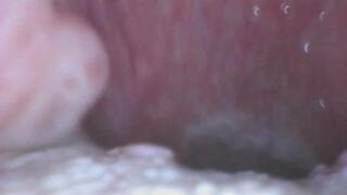 Felicia Swallows Gummy RAW ENDOSCOPE
