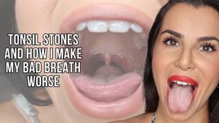 Tonsil stones and how I make my bad breath worst - Lalo Cortez and Vanessa (custom clip)