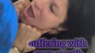 suffering with open mouth long farts