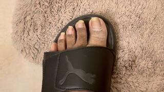 Ashy Feet, Crusty Heels and Long Toenails