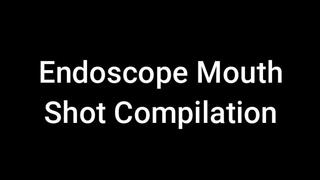 Endoscope Mouth Shot Compilation