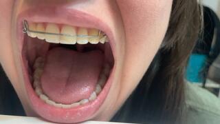 Climb into cute giantess's retainer mouth