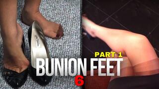 Fetish207 - Foot Fantasies, Bunion Feet 6, Part 1