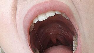 Big mouth yawn! MP4