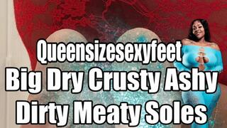 Big Dry Crusty Ashy Dirty Meaty Soles Sexy Talk BackShot View