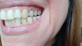 Lania shows her dirty teeth and chooses you to be eaten next