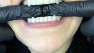 Mouth check Mouth check Mouth check