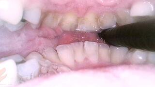 Mouth Cam - Rachel Adams - 1080 2nd