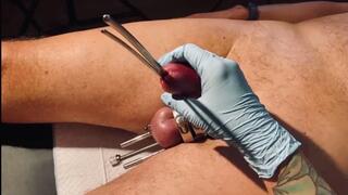 Intense CBT Challenge