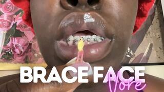 Brace Face Vore