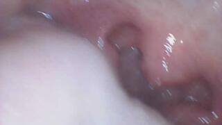 Haley Endoscope Tour and a Snack