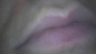 Marylin Endoscopic Snack