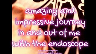 AMAZING AND IMPRESSIVE JOURNEY!! in and out of me with the endoscope