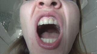 Dirty teeth and bad breath