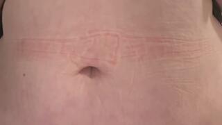 Huge belly after dinner