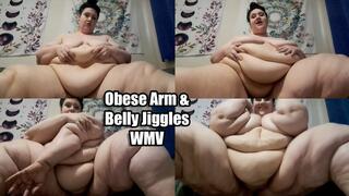 Obese Arm & Belly Jiggles (WMV)